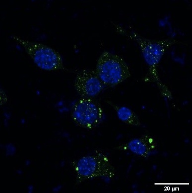Fluorescence micrograph of cells with blue nuclei and green signal.